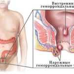 gemorooy-1