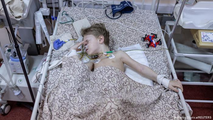 Поранена трирічна дитина на ім'я Діма з Маріуполя у лікарні Запоріжжя, фото 29 березня 2022 року