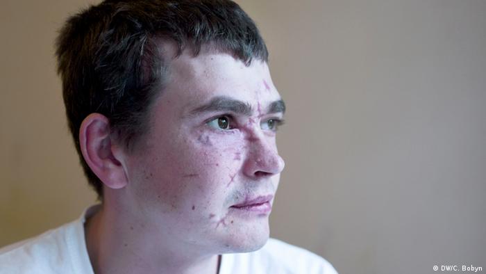 28-річний Андрій, призовник із Києва, підірвався на міні у Донецькій області. 